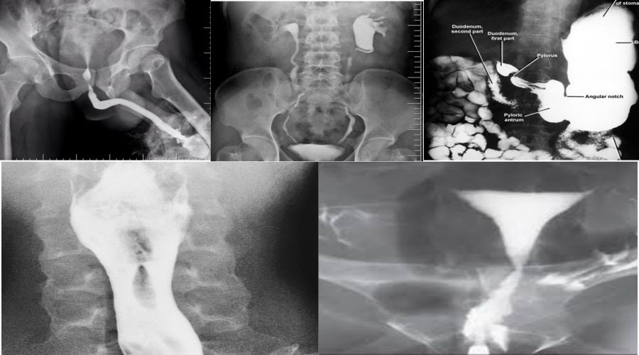 Conventional Radiology Procedures