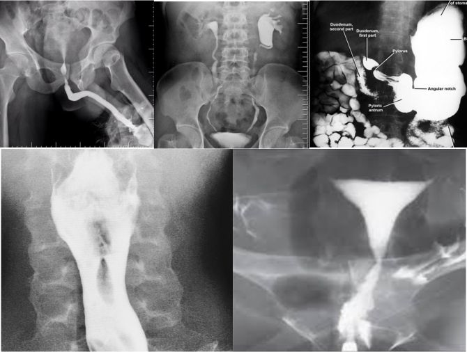 Radiology Process